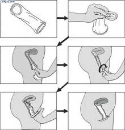 Mách bạn, cách sử dụng bao cao su đúng khi quan hệ tình dục